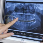 The Importance of Regular Dental Checkups.