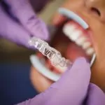 Guarding Your Smile: Understanding and Managing Teeth Grinding