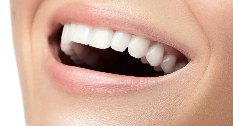 white teeth guide
