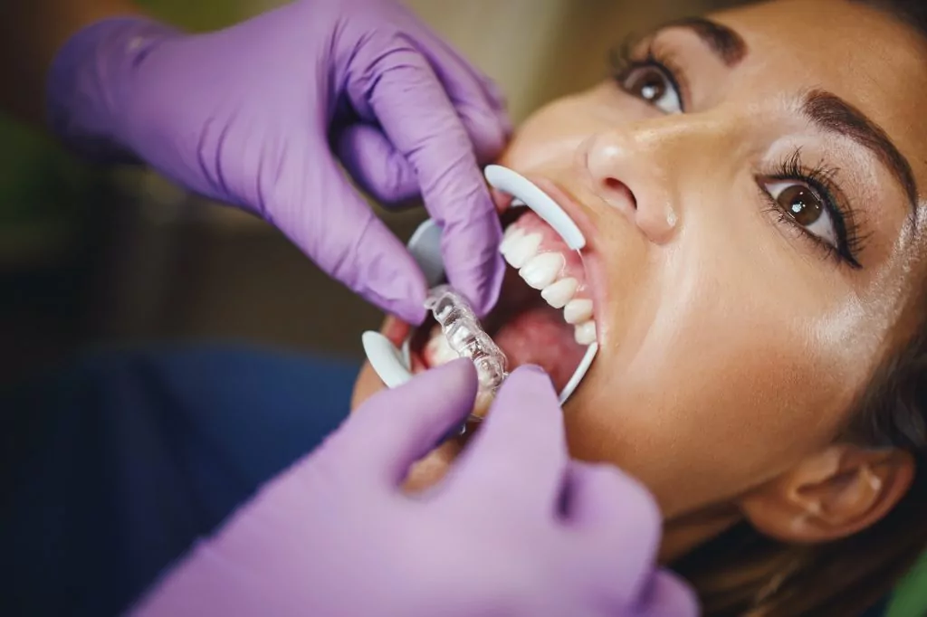 Aesthetic Dentistry