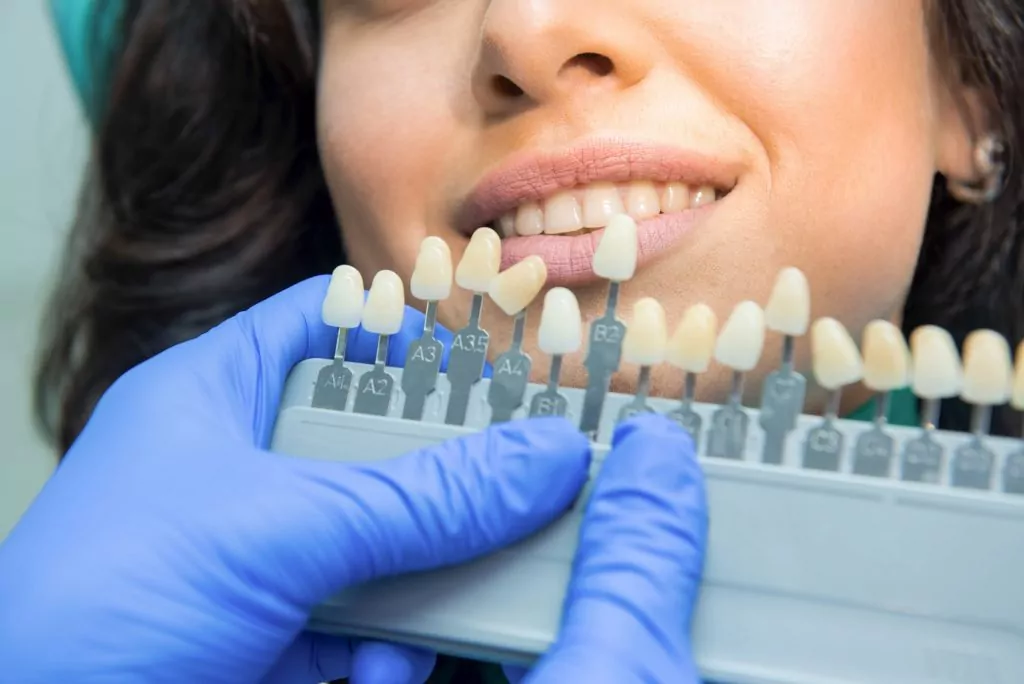 professional whitening teeth