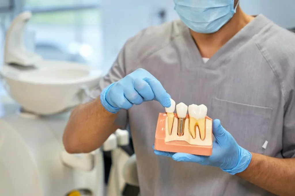 options for tooth replacement